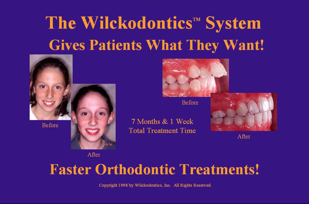 Wilkodontics slider image | Faster Orthodontic Treatments 