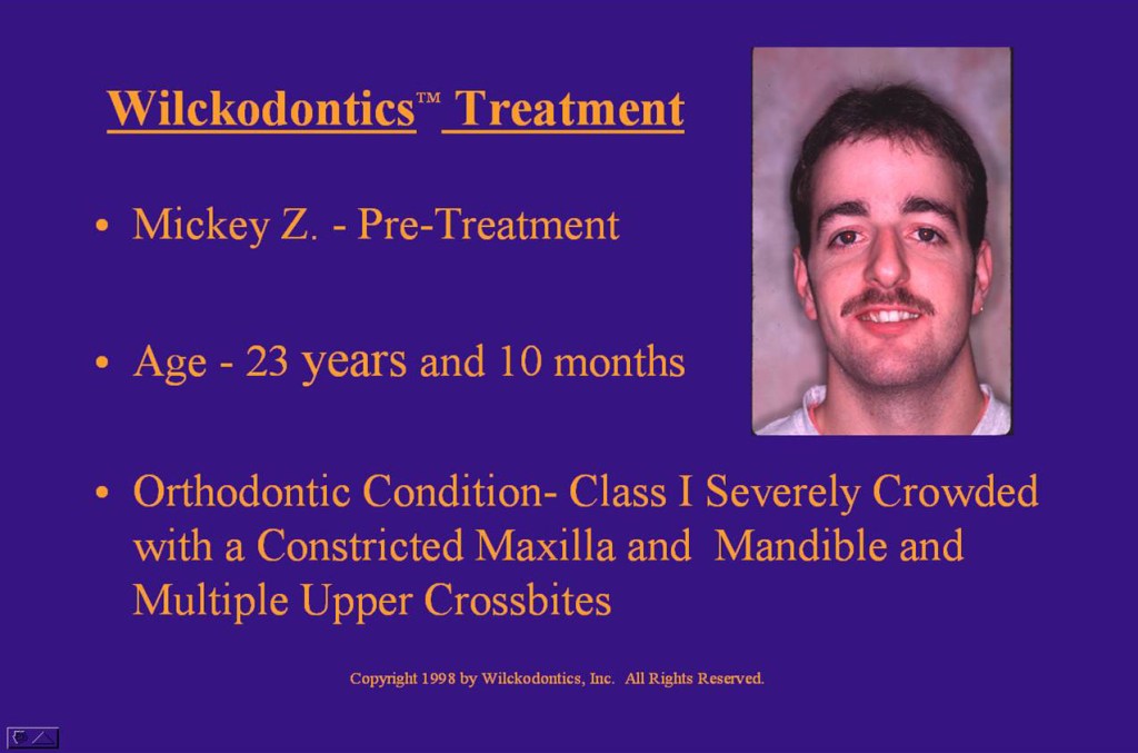 Wilkodontics slider image | Mickey Z | Case Study 