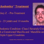 Wilkodontics slider image | Mickey Z | Case Study 