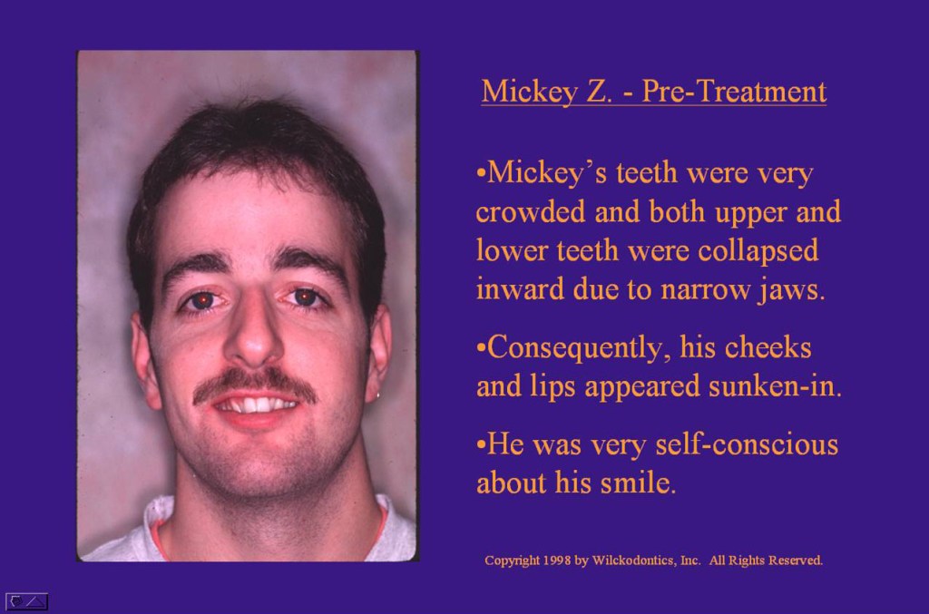 Wilkodontics slider image | Mickey Z | Case Study 