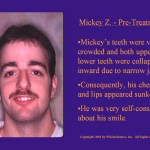 Wilkodontics slider image | Mickey Z | Case Study 