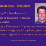 Wilkodontics slider image | Mickey Z | Treatment Photos 