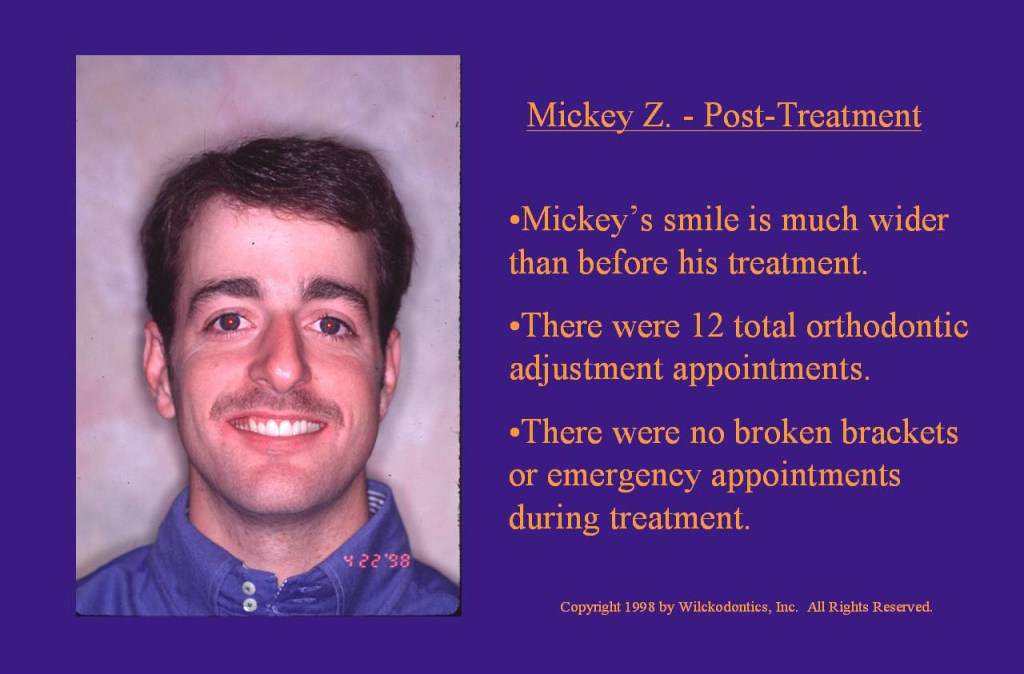 Wilkodontics slider image | Mickey Z | Post Treatment 