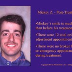 Wilkodontics slider image | Mickey Z | Post Treatment 