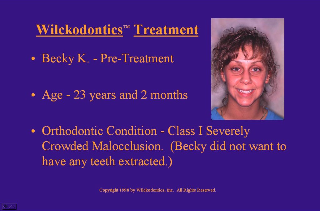 Wilkodontics slider image | Becky K | Treatment Plan