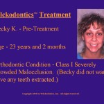 Wilkodontics slider image | Becky K | Treatment Plan
