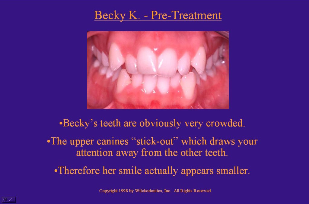 Wilkodontics slider image | Becky K | Case Study  