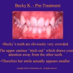 Wilkodontics slider image | Becky K | Case Study  