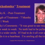Wilkodontics slider image | Becky K | Treatment 