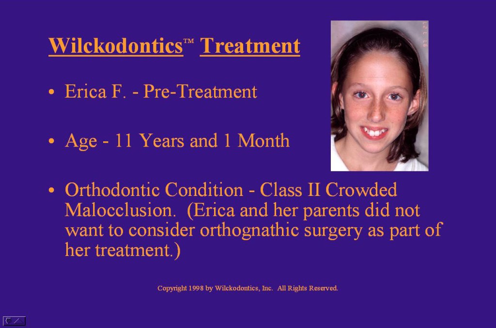 Wilkodontics slider image | Erica F | Treatment Plan 