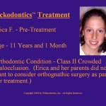 Wilkodontics slider image | Erica F | Treatment Plan 