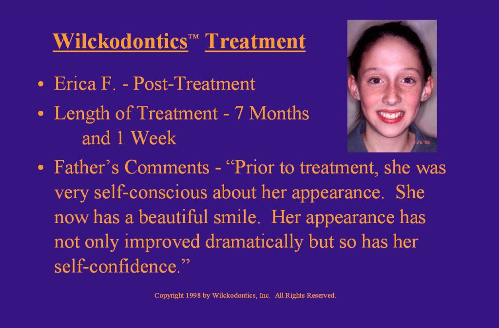 Wilkodontics slider image | Erica F | Treatment Plan 