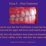 Wilkodontics slider image | Erica F | Post Treatment Case Study 