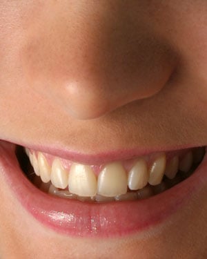 A person with a beautiful smile
