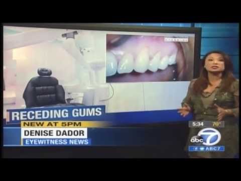 Painless Treatment For Receding Gums on ABC 7 L.A.